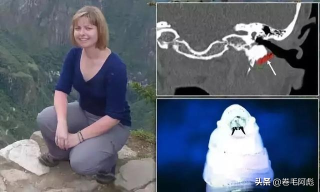 美国女子吃蜱虫被咬死,美国女子被虫子咬