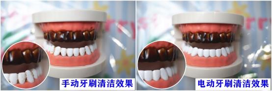 使用超声波电动牙刷有什么危害吗,电动牙刷的危害弊端