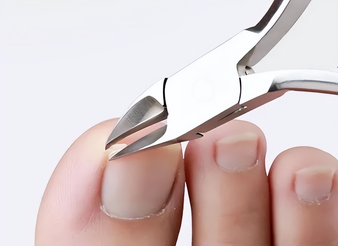 脚趾甲往肉里面长很疼算甲沟炎吗,脚趾甲老往肉里钻一碰还疼