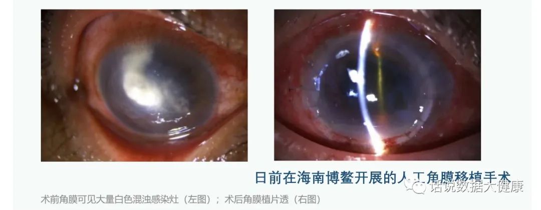 浜哄伐瑙掕啘瑙嗗姏鎭㈠,鐪肩潧澶辨槑鏇存崲浜哄伐瑙掕啘