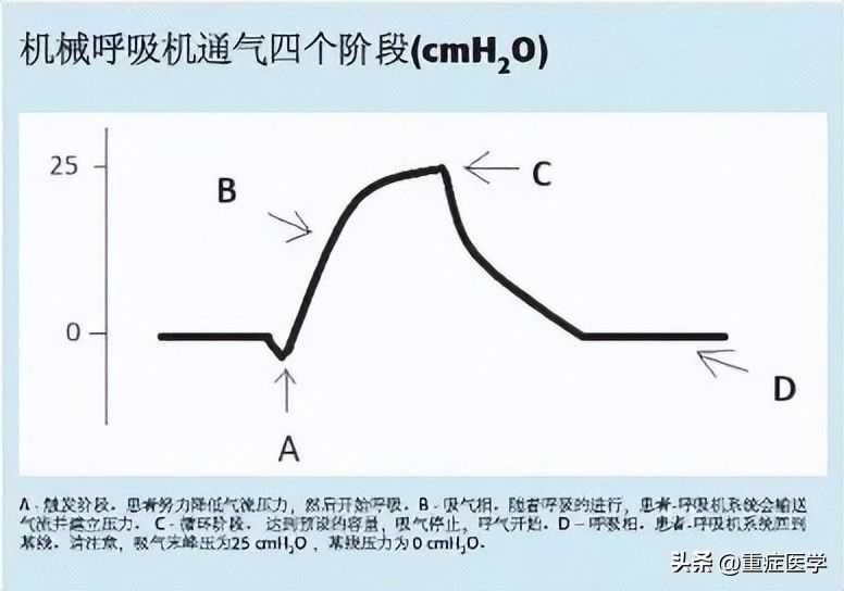 成人机械通气,成人机械基础课程设计