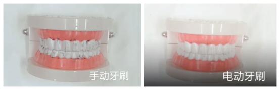 戴牙套了还能用电动牙刷吗,牙套电动牙刷