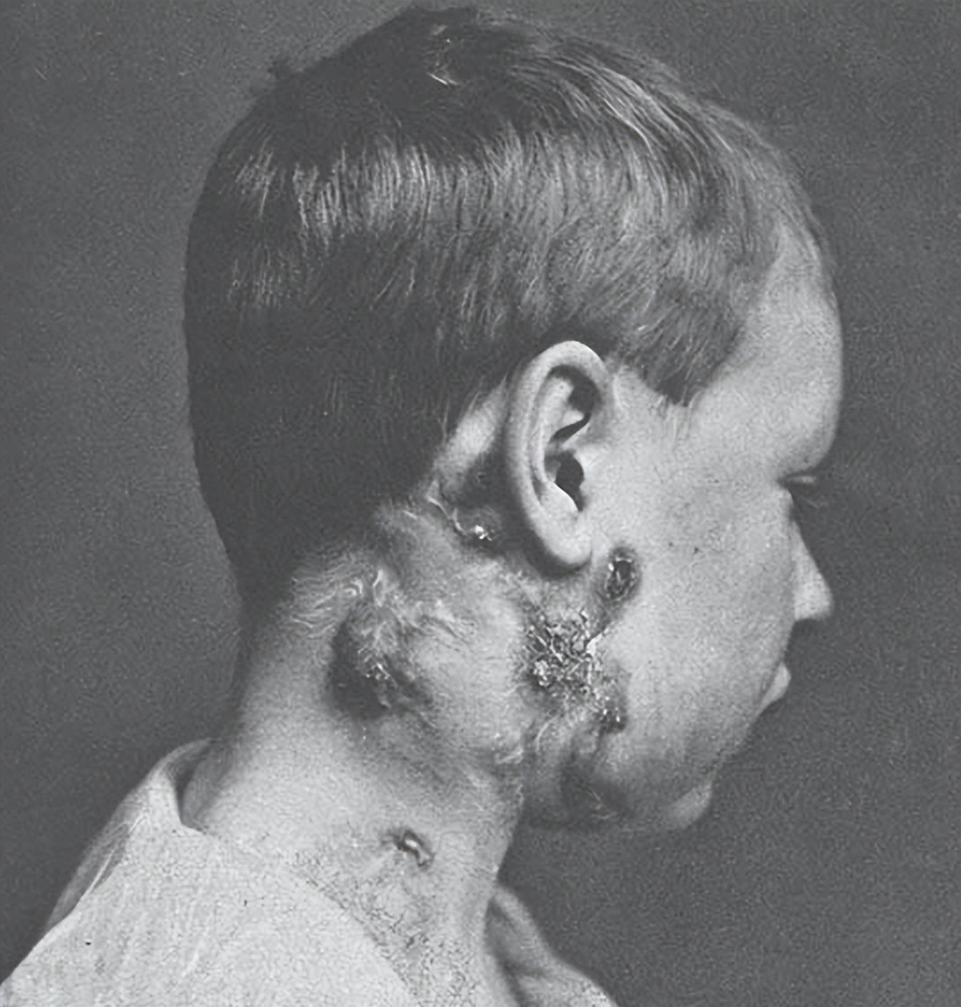 法国国王的最离奇的治疗方法,国王摸头治病