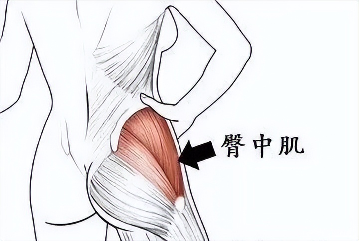 走路像鸭子是哪块肌肉的问题,走路像鸭子一样的是什么原因