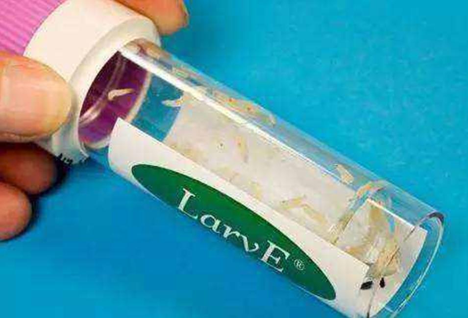 男子被烧伤医生拿来10万条虫,21岁小伙被严重烧伤