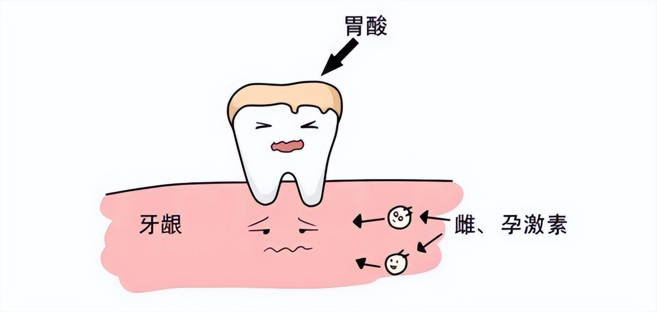 孕期牙疼不能吃药怎么办,孕期牙疼不治疗自己能好吗