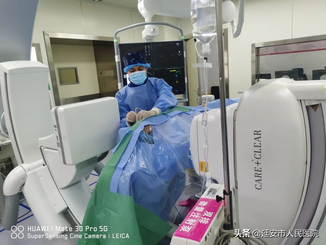 延安市人民医院疼痛康复科成功开展射频热凝术治疗三叉神经痛