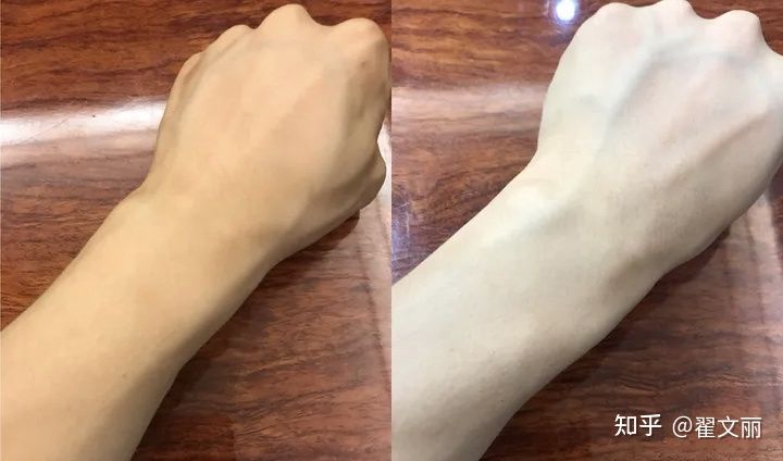 比较温和的美白祛斑精华,小编给大家推荐几款有效祛斑精华