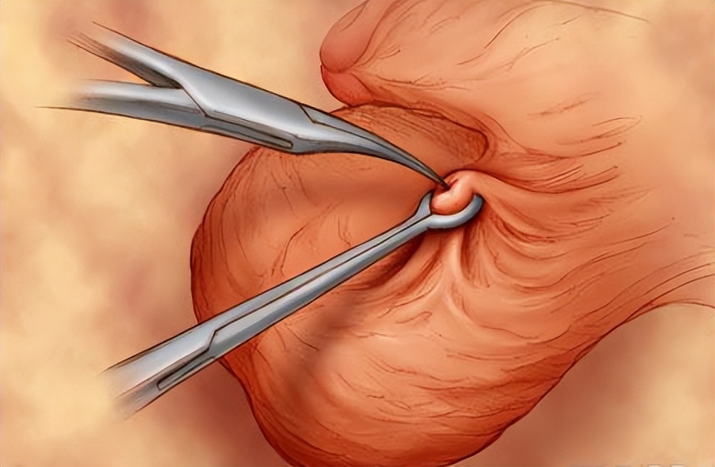 月经前几天是安全期时间表,例假前是安全期还是后是安全期