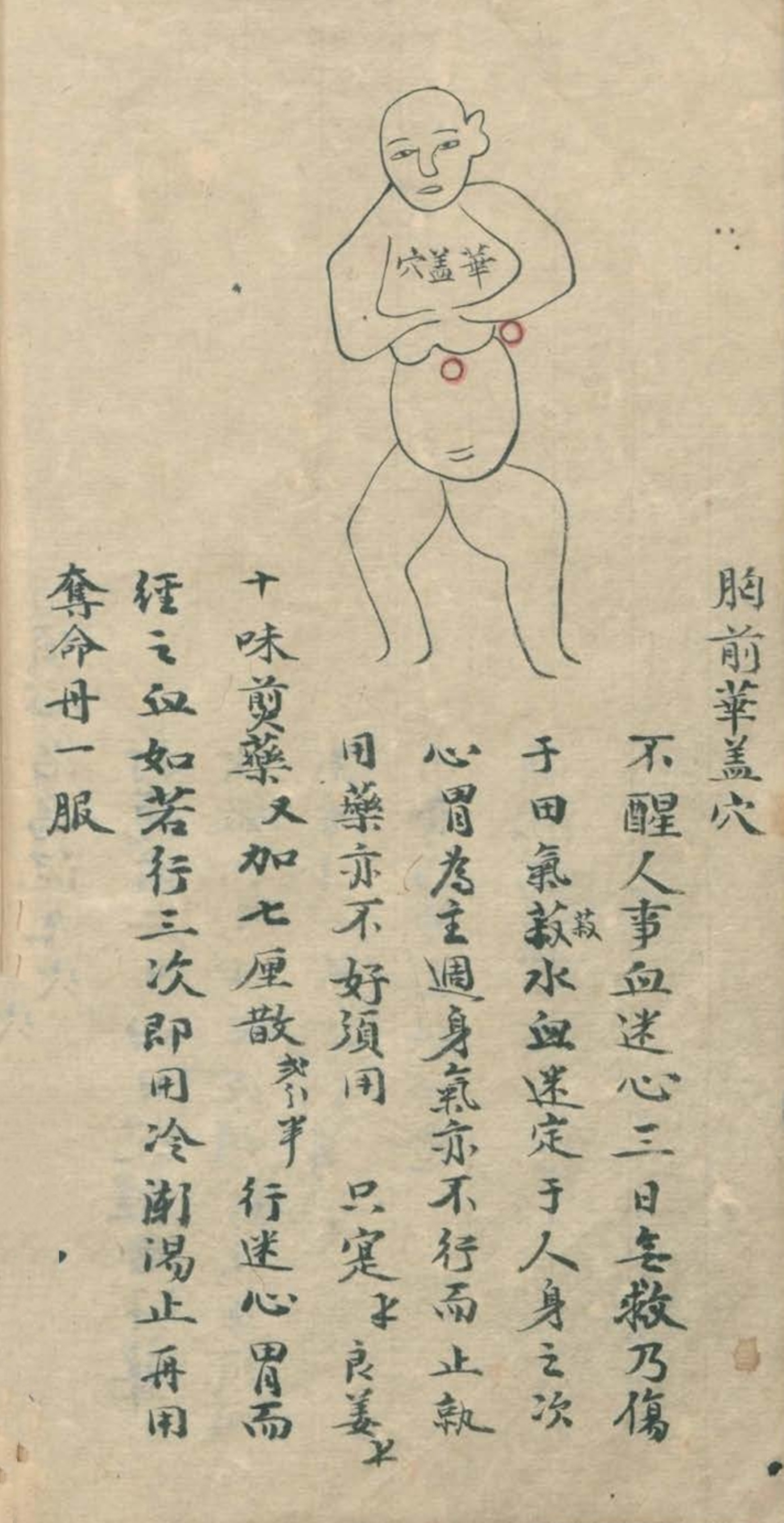 最实用的跌打药方,祖传跌打秘方100首