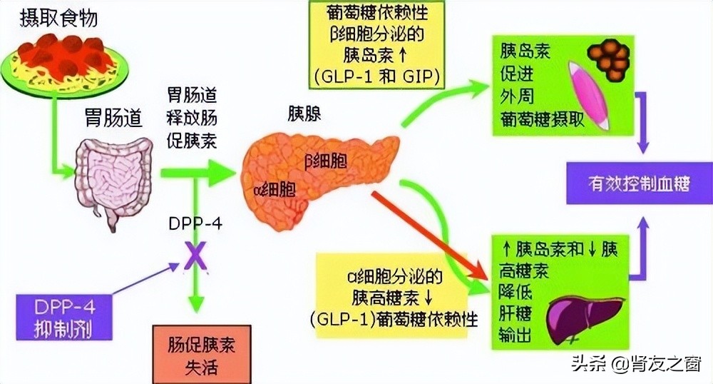 2类糖尿病跟胰腺有关吗,糖尿病病人的肠促胰素