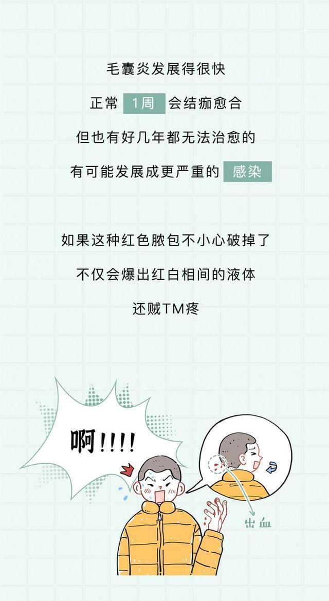 头皮上的白色颗粒,头皮上的白色颗粒是虱子吗