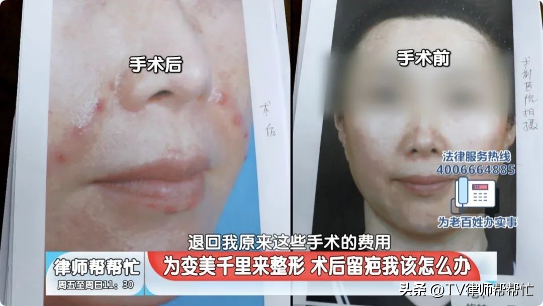 为了变美去整容最后倒在了手术台,为了变美却做了隆胸手术