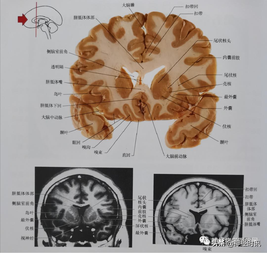 ct袖珍断层解剖图谱最新版,头颅ct断层解剖图谱无水印