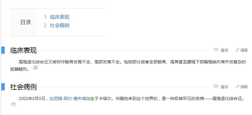 卡塔尔半身男孩背后故事,卡塔尔半身少年开幕式