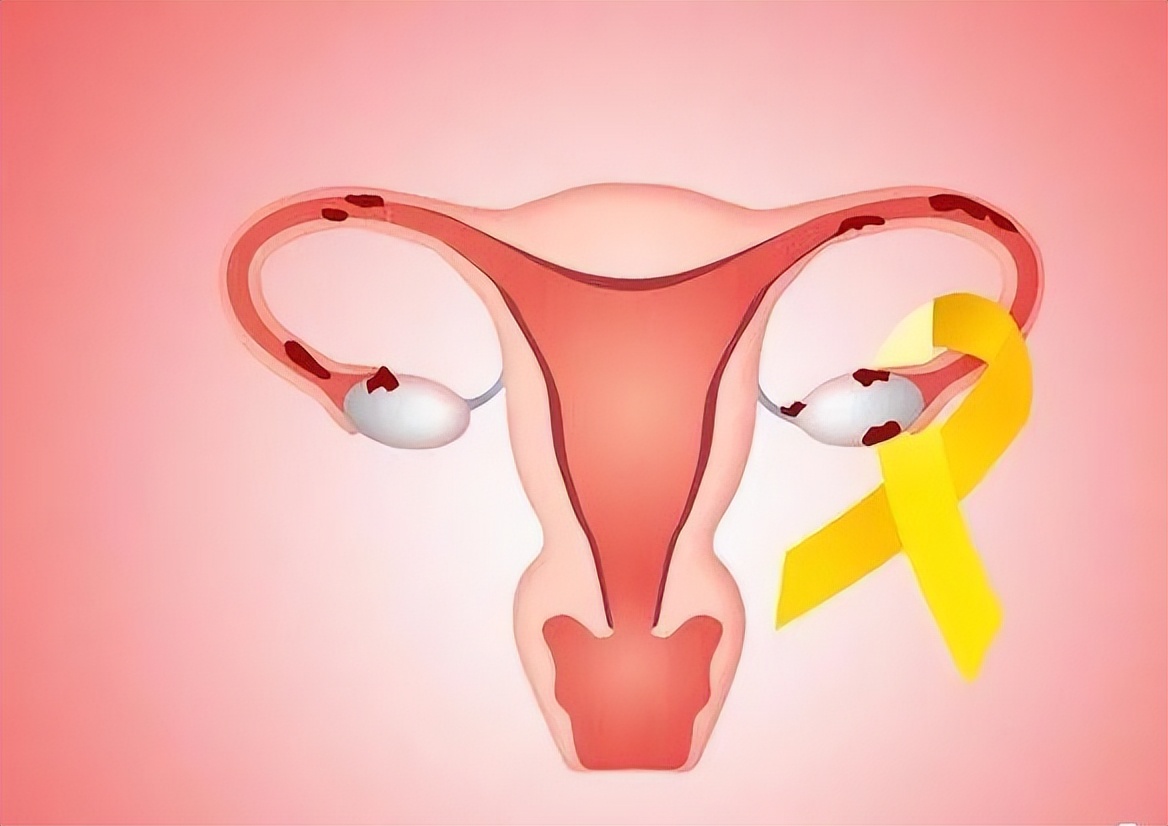 女生大姨妈来血块怎么回事,大姨妈来了排出一坨坨的血块