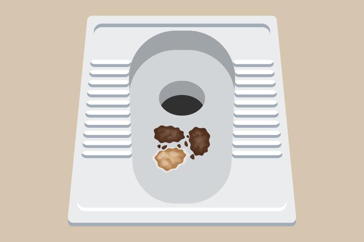 排出的大便一粒一粒的，像“羊粪球”，是怎么回事？如何缓解？