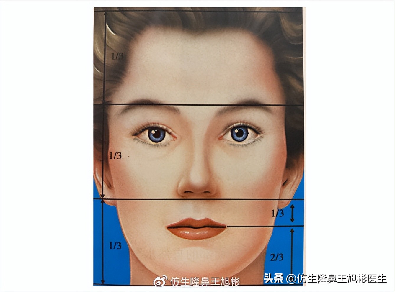 鼻整形最简易方法,鼻孔又大又塌又朝天鼻整形