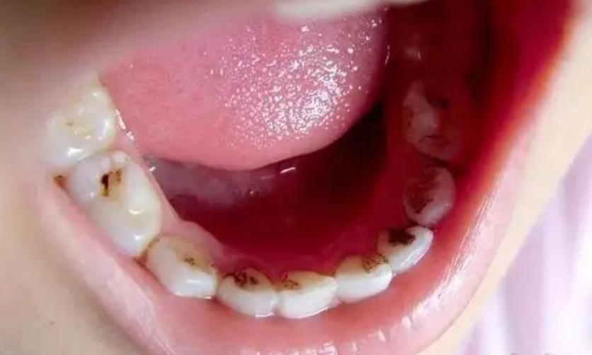 315黑榜床垫,315质量被曝光的床垫有哪些