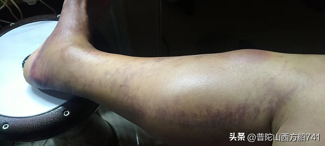 太平寺足球的故事（规则）