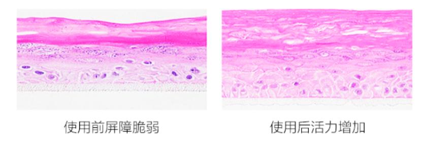 修复敏感肌抗衰老,扎心用什么方法可以缓解