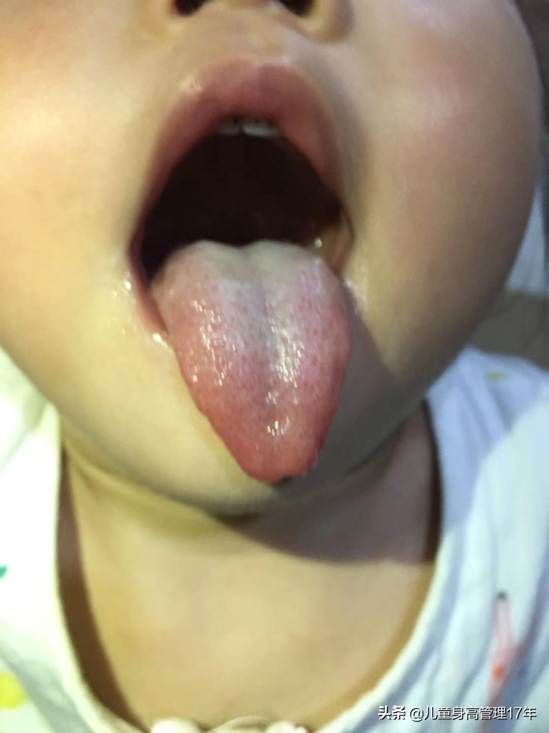 孩子长个慢六种潜在原因,孩子不长个有哪些方法可以解决