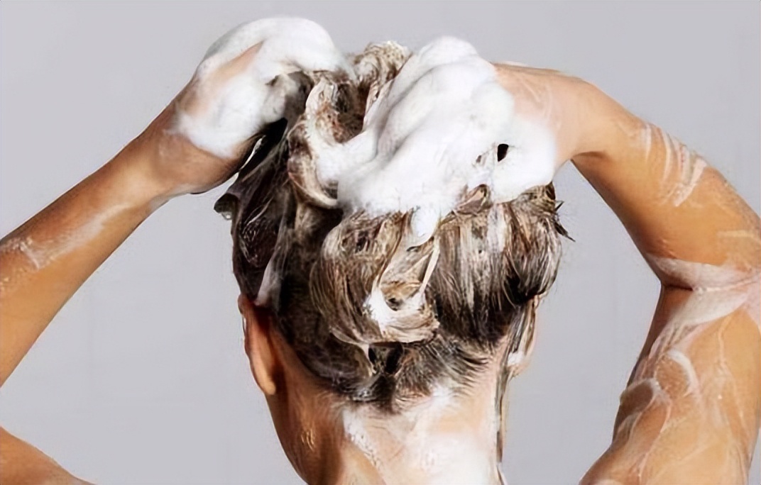 头皮屑很多头皮痒？头皮屑原因解析，3招改善头皮屑问题