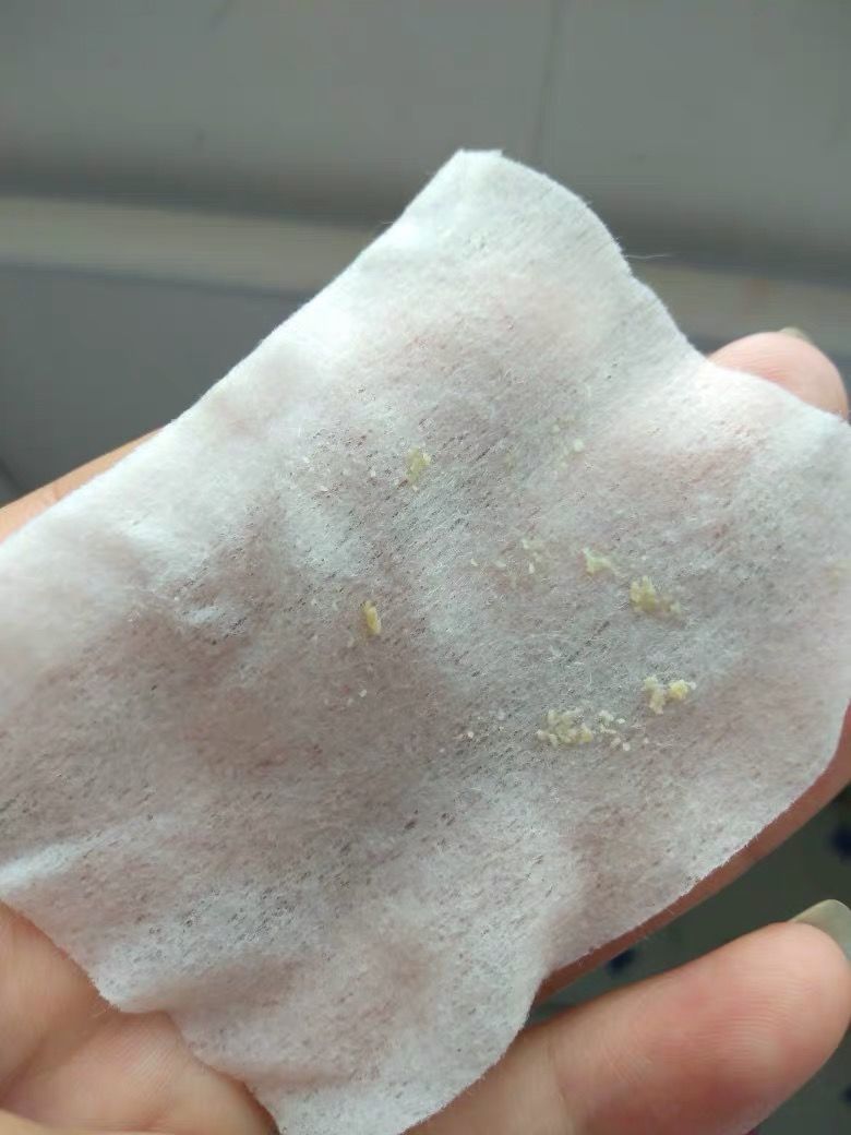 鼻子上好多黑头把毛孔堵住了,鼻子上的黑头怎么去除最有效方法