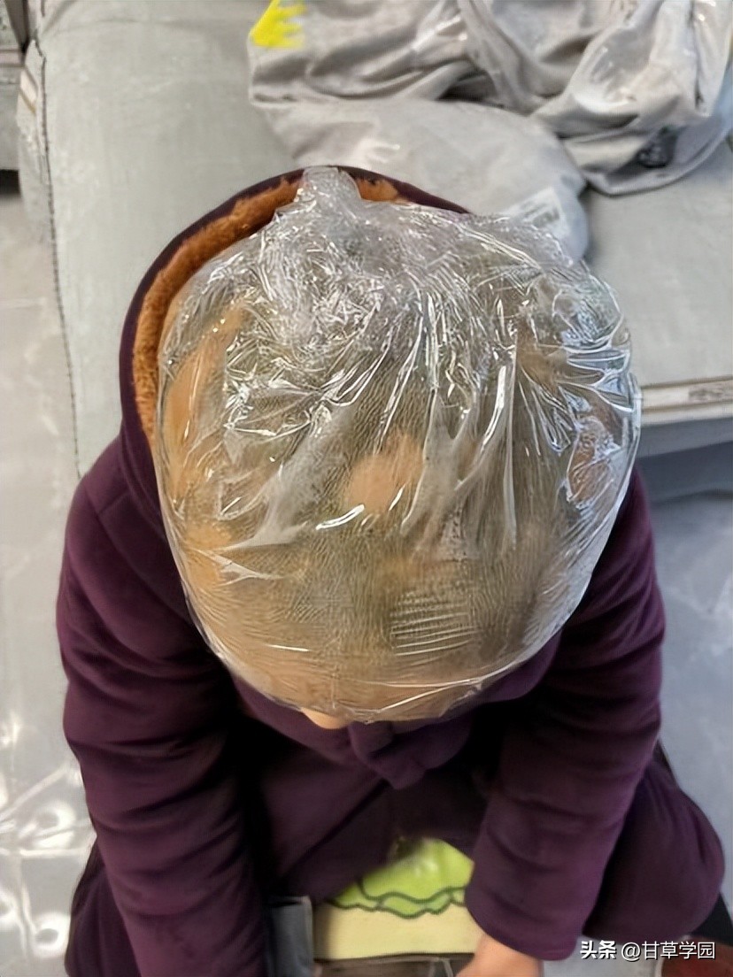 复方甘草治疗斑秃,甘草煮水治疗斑秃效果好吗