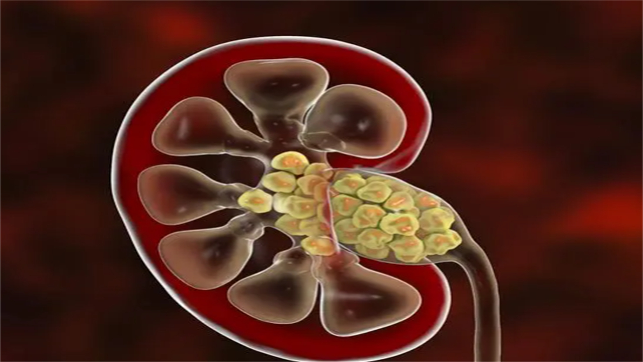 泌尿系统的彩超检查是什么,腹部彩超及泌尿系统彩超注意事项