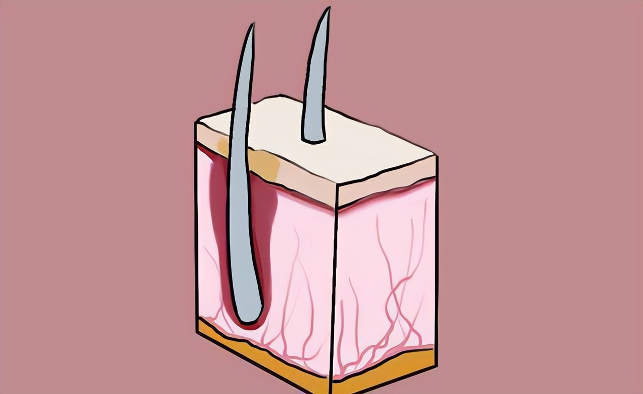 为什么有的人会长“肛毛”？可以直接刮掉吗？早了解早受益