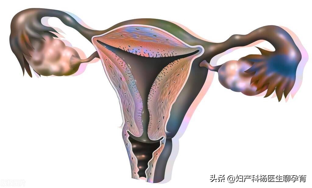 宫颈内口松弛导致孕早期流产,宫颈松弛导致流产症状是什么