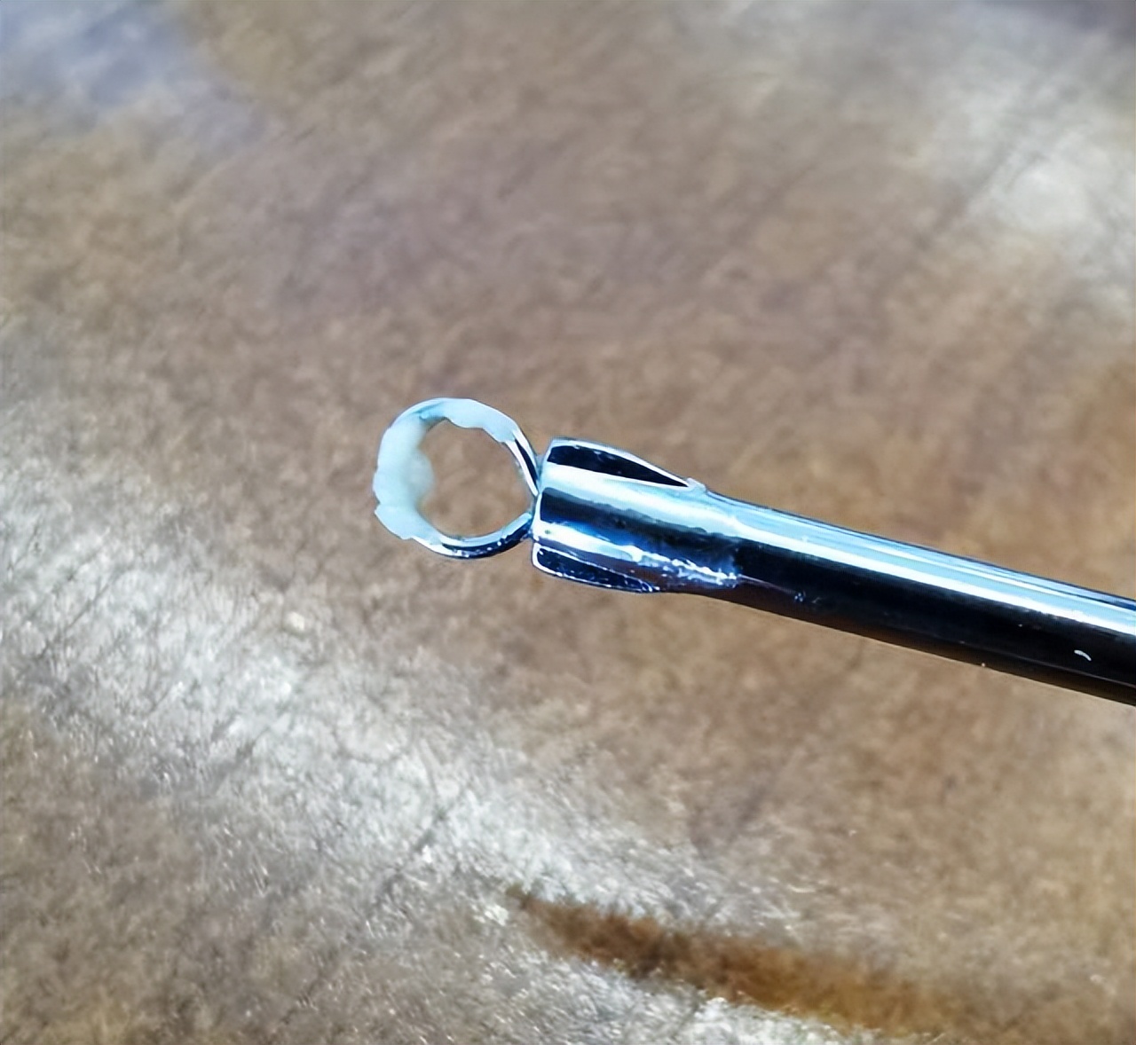 鼻头长黑粉刺怎么回事图片,鼻梁及两侧起了闭口粉刺