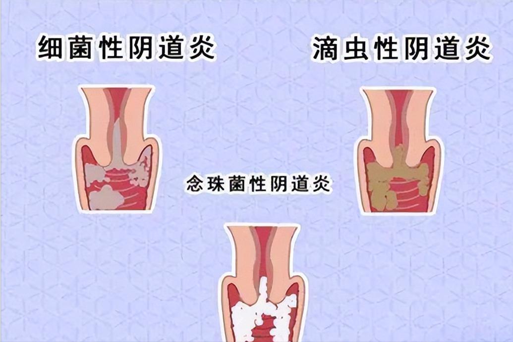 散装卫生巾好用,网上的散装卫生巾可以用吗