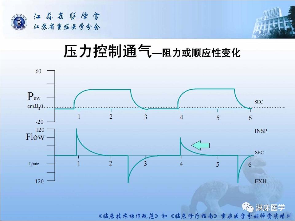 机械通气患者气道管理ppt,机械通气基础知识ppt