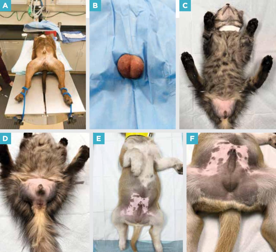 附睾炎切除术多少钱,附睾炎微创手术治疗全过程