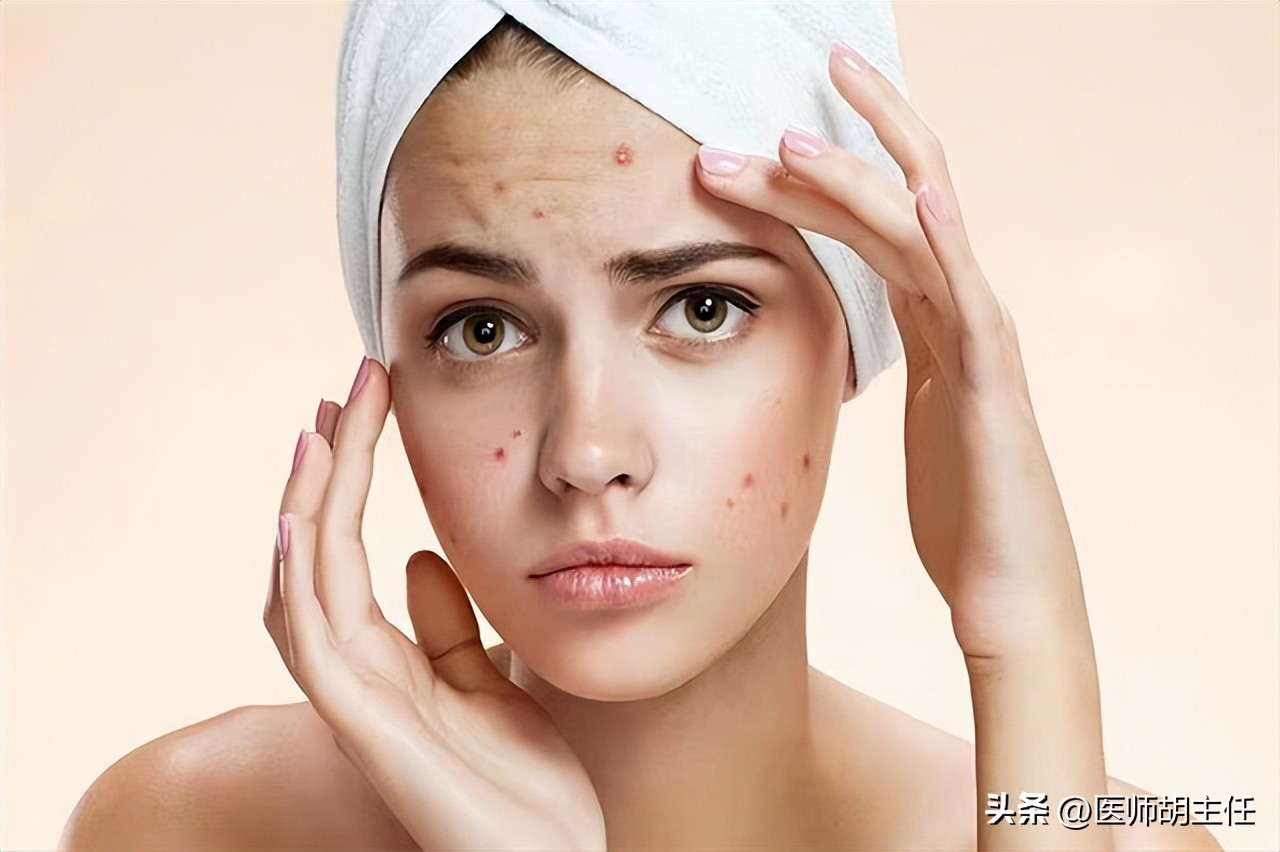 带状疱疹令人疼痛难忍该如何预防,哪些是带状疱疹患者要纠正的误区