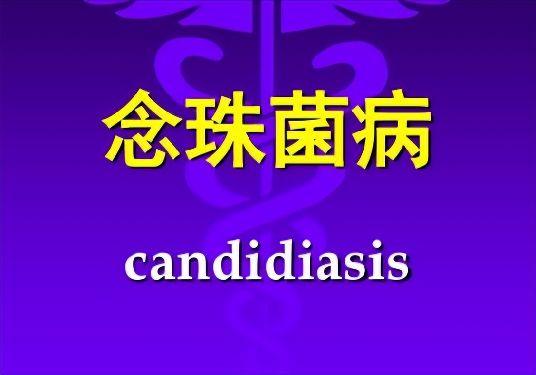 尿路感染最常见的致病菌有哪些,发生尿路感染最常见的感染途径是