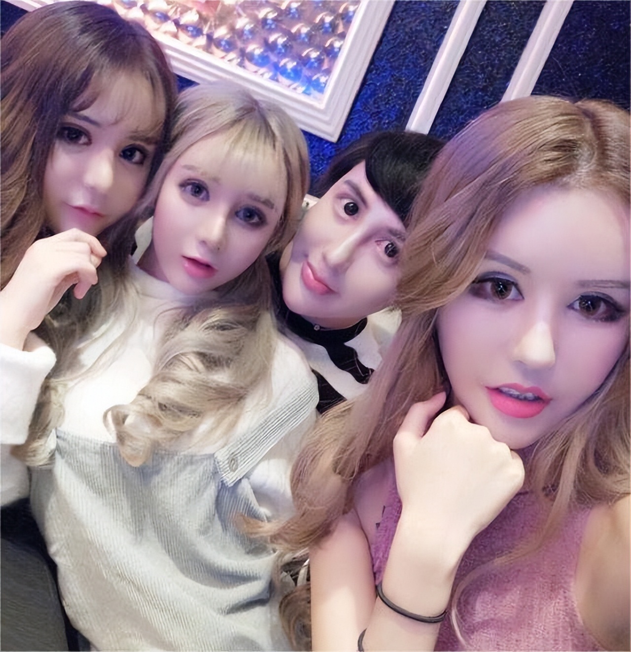 整鼻前后对比,整鼻技术有哪些