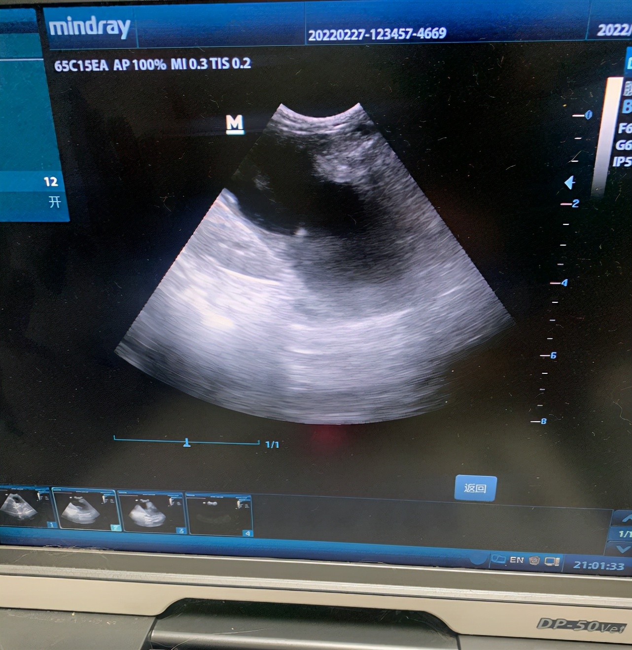 猫咪黄疸肝炎吐大量黄水,猫咪肝炎黄疸黄栀口服液有用吗