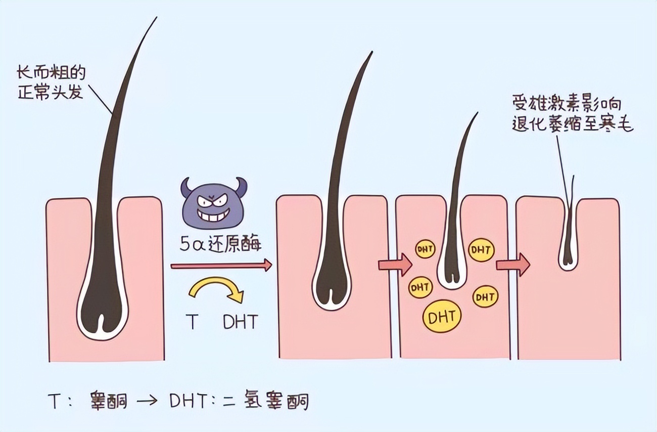 脱发根本就不能治,脱发治不了的视频