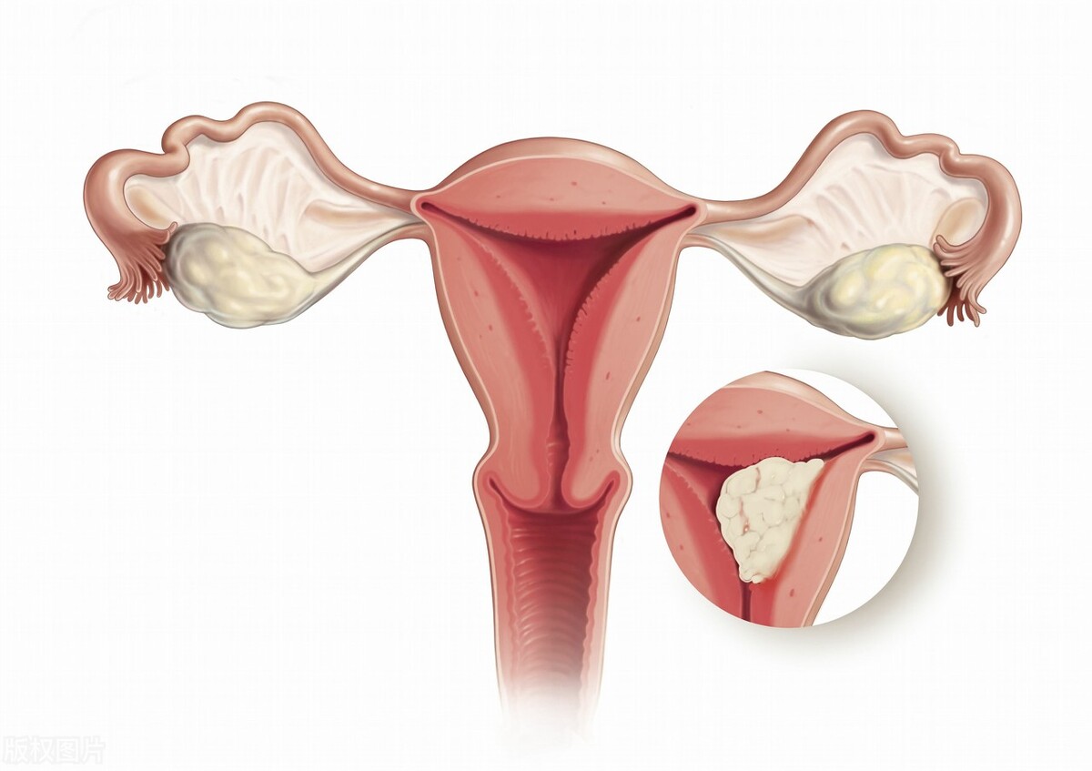女性的阴道该怎么护理？医生：注意这5大细节，或可远离妇科疾病