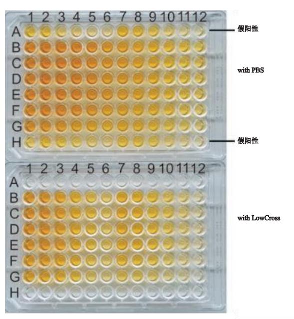 常见的免疫分析方法,免疫检验有哪些干扰