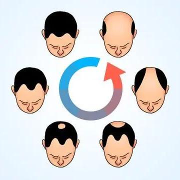 太“秃”然！如何守住“头”等大事