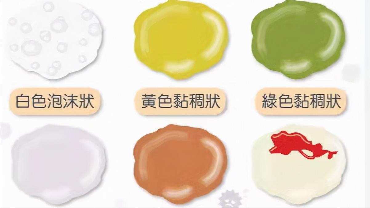 肺部有痰咳不出来的解决妙招,肺部咳出很多痰是快好了么