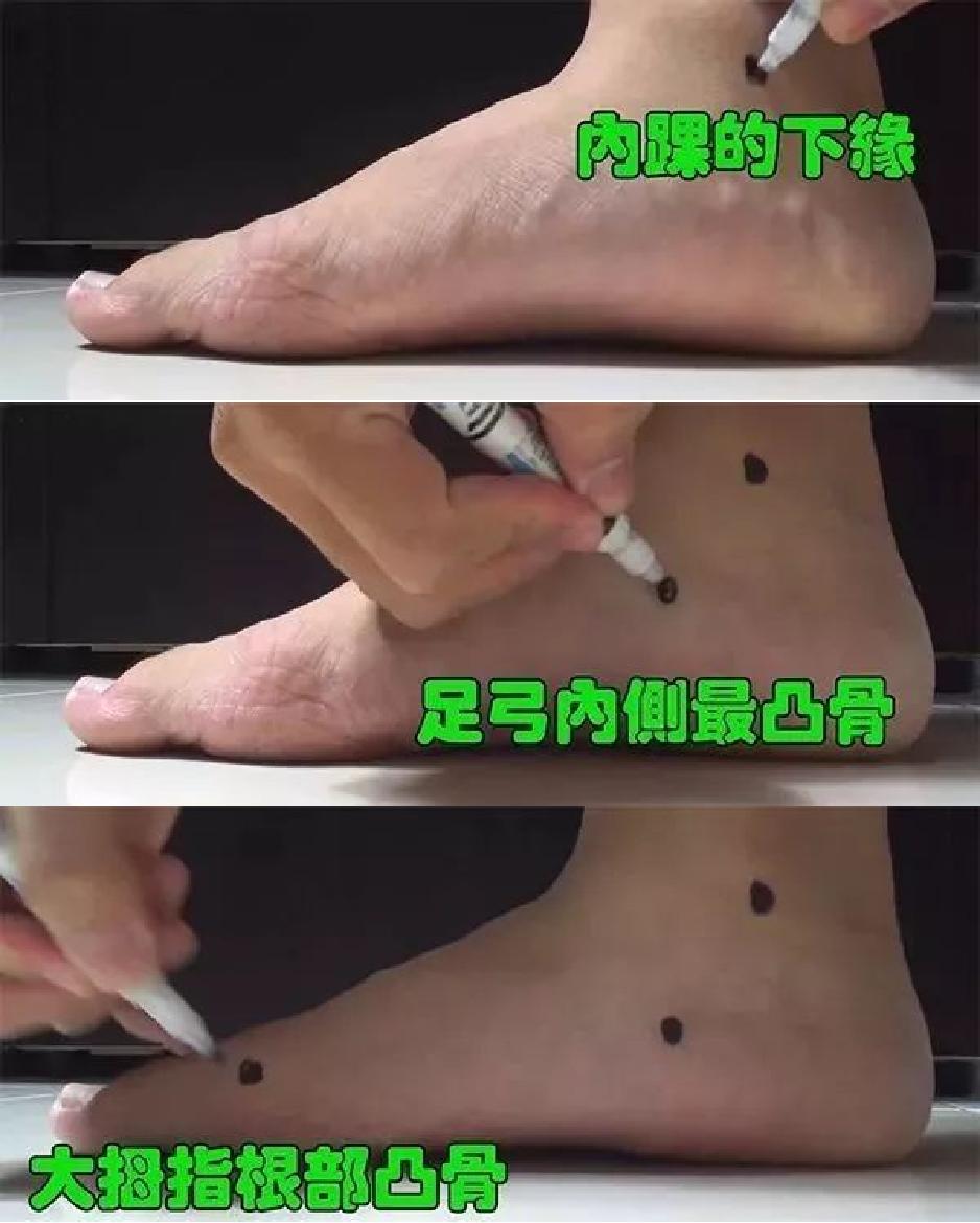 扁平足穿鞋子有什么讲究吗,扁平足要穿专用的鞋子吗