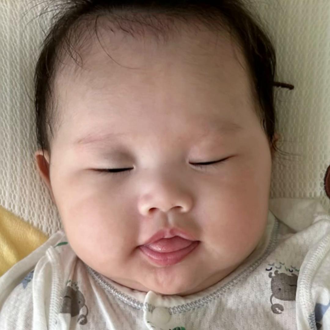 随手一个赞,长太田痣的宝宝