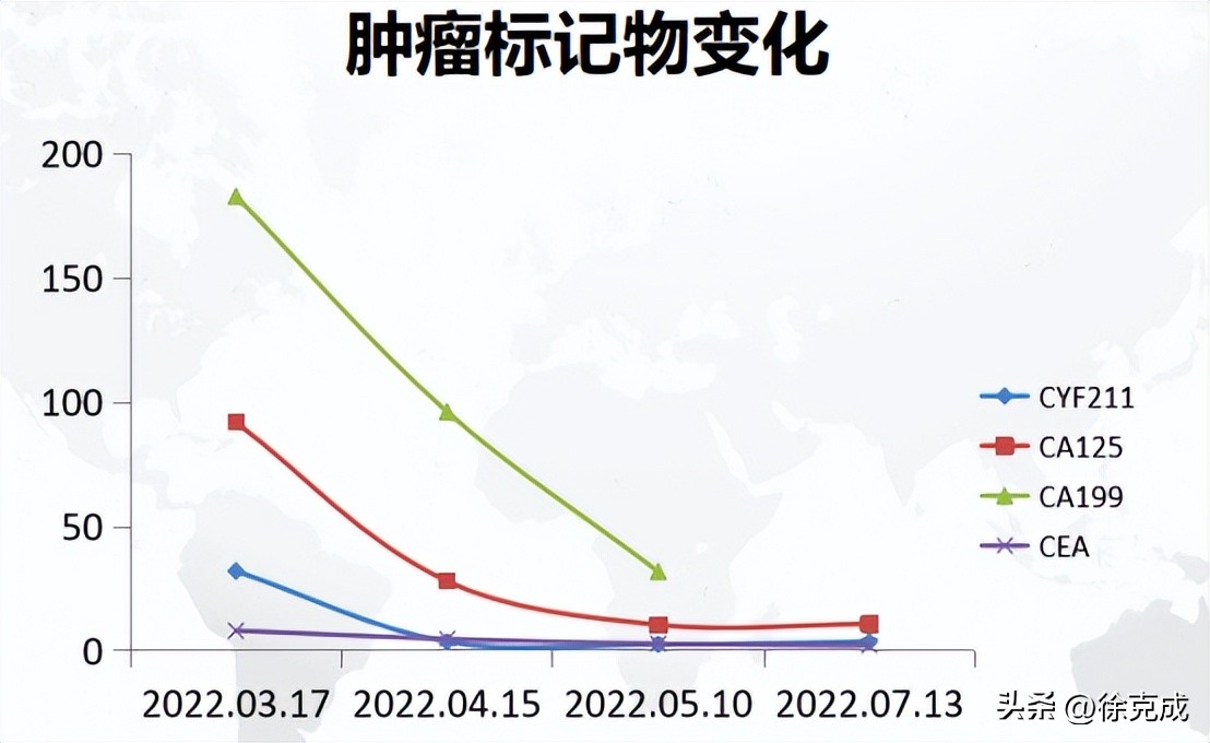 肺癌电场疗法,肺癌吸入疗法