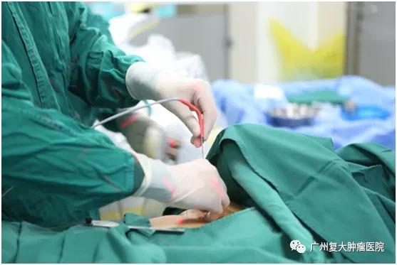 肺结节该观察还是手术？或许微创消融治疗是个不错的选择