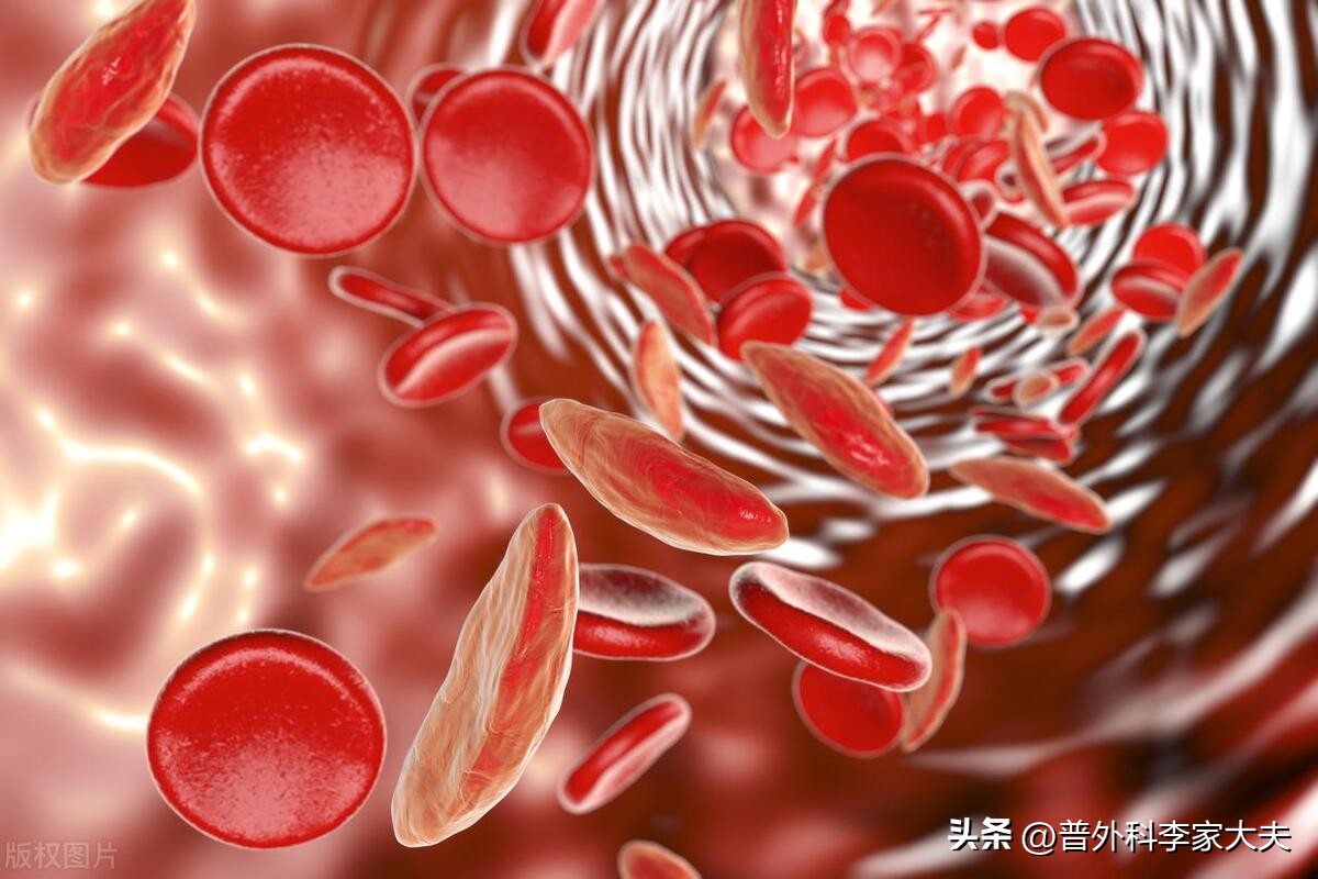 血红蛋白低可以化疗吗,化疗后血红蛋白低怎么办